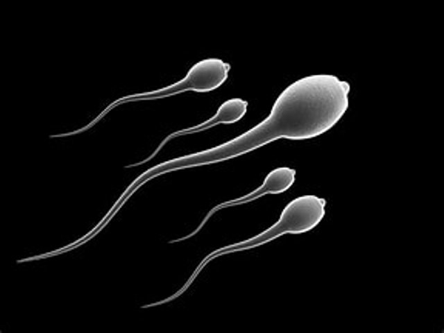 sperm